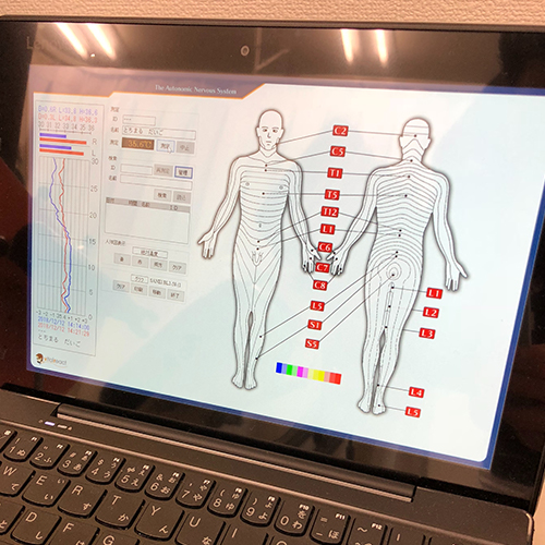 DTG検査：高感度赤外線センサーで背骨皮膚状の体温を測定します。体温のムラから自立神経の機能を計ります。